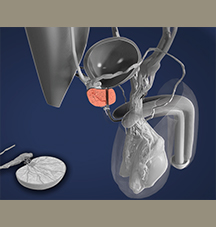 Prostate Awareness Graphic
