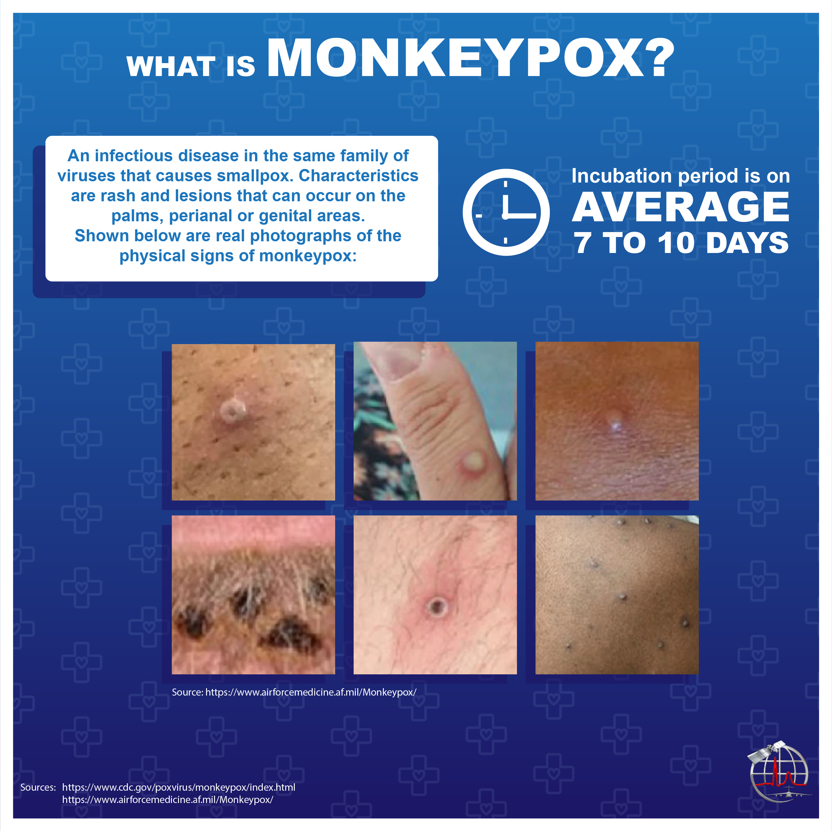 Image of monkeypox graphic